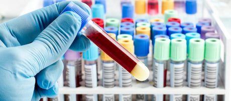 Regular Blood Testing: Getting the Real Score of Your Wellness Game